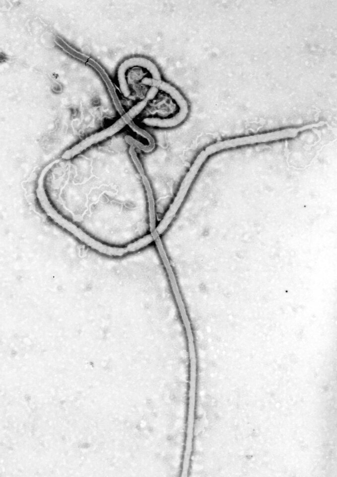 Micrografia do vírus ebola. Imagem de arquivo ilustrativa.